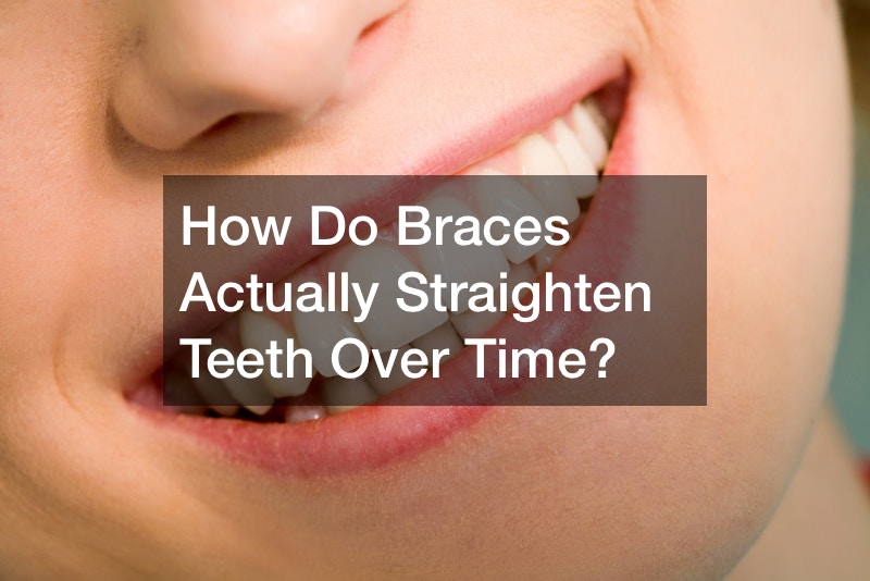 How Do Braces Actually Straighten Teeth Over Time?