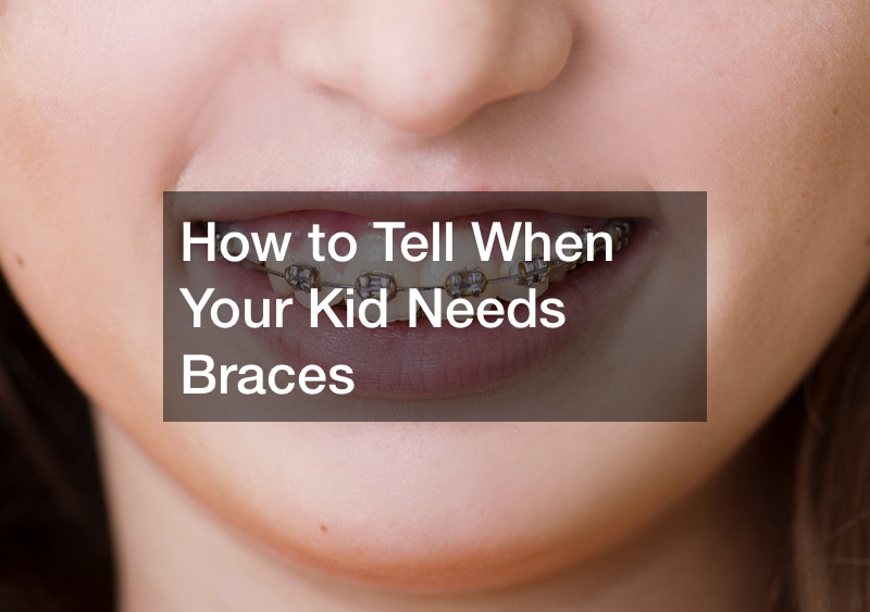 How to Tell When Your Kid Needs Braces