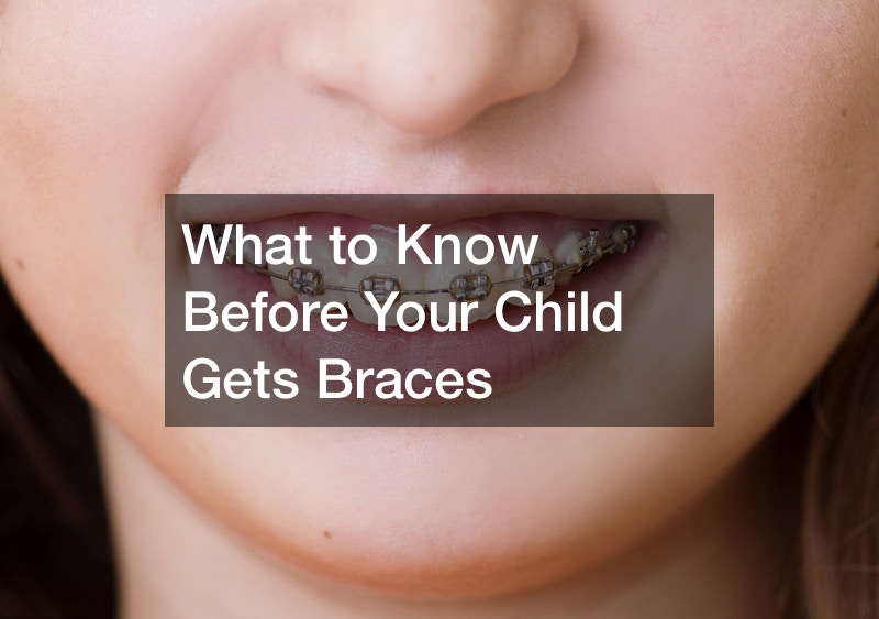 What to Know Before Your Child Gets Braces