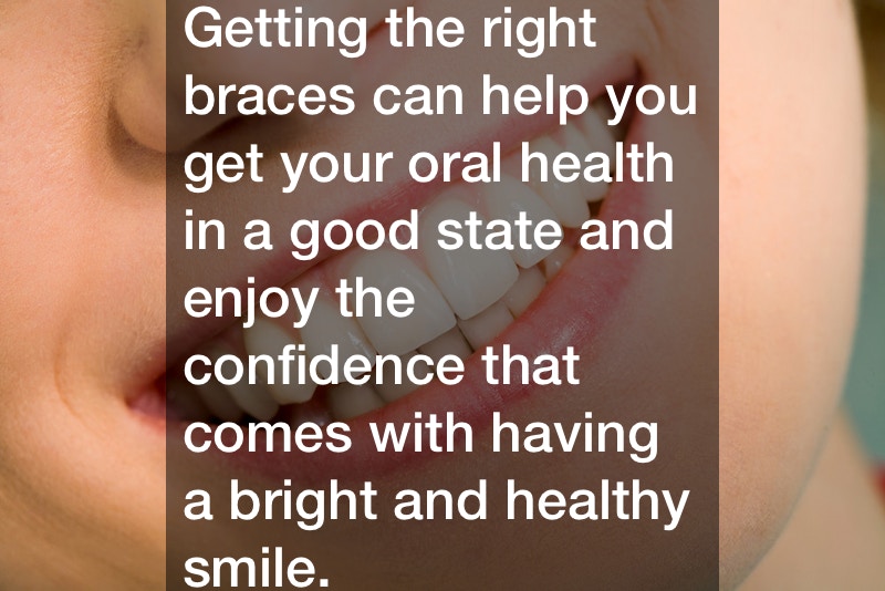 The Modern Day Braces Debate: Lightforce Braces vs Metal Braces What’s Right For You