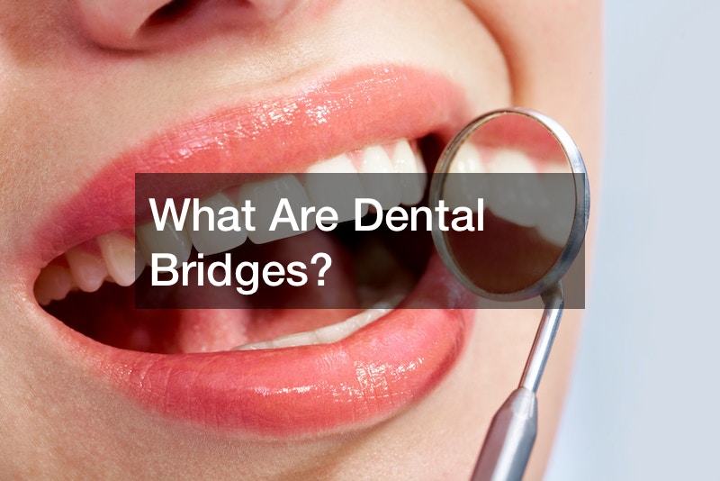 What Are Dental Bridges?