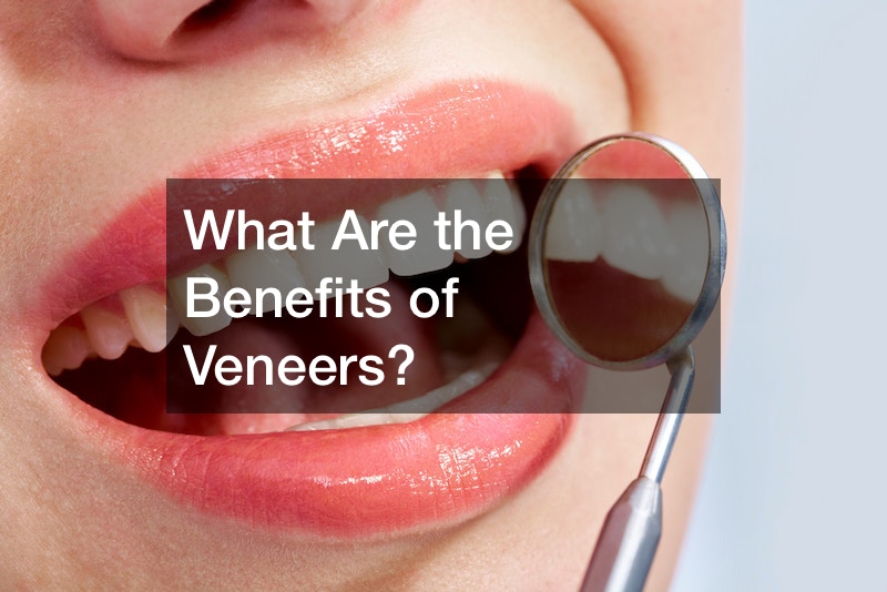 What Are the Benefits of Veneers?