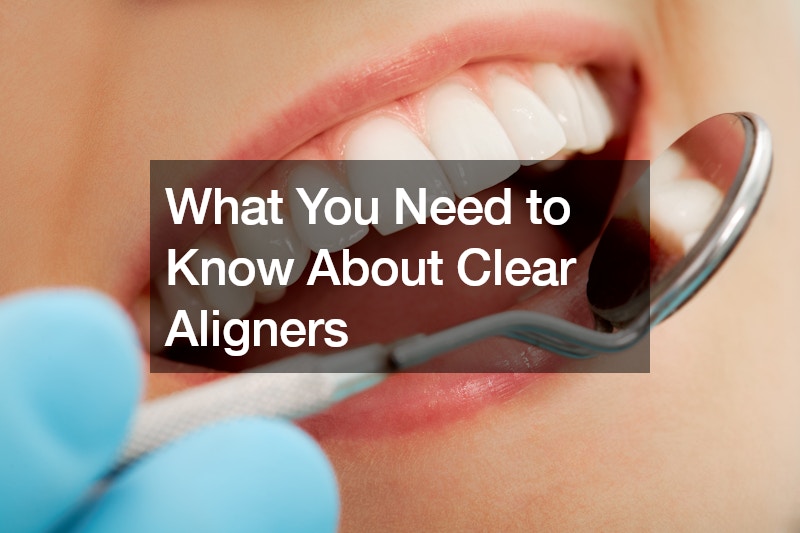 What You Need to Know About Clear Aligners