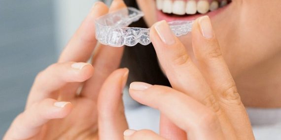 a woman about to wear a clear aligner