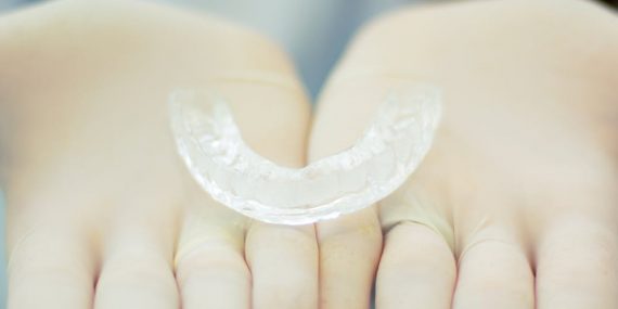 a clear aligner